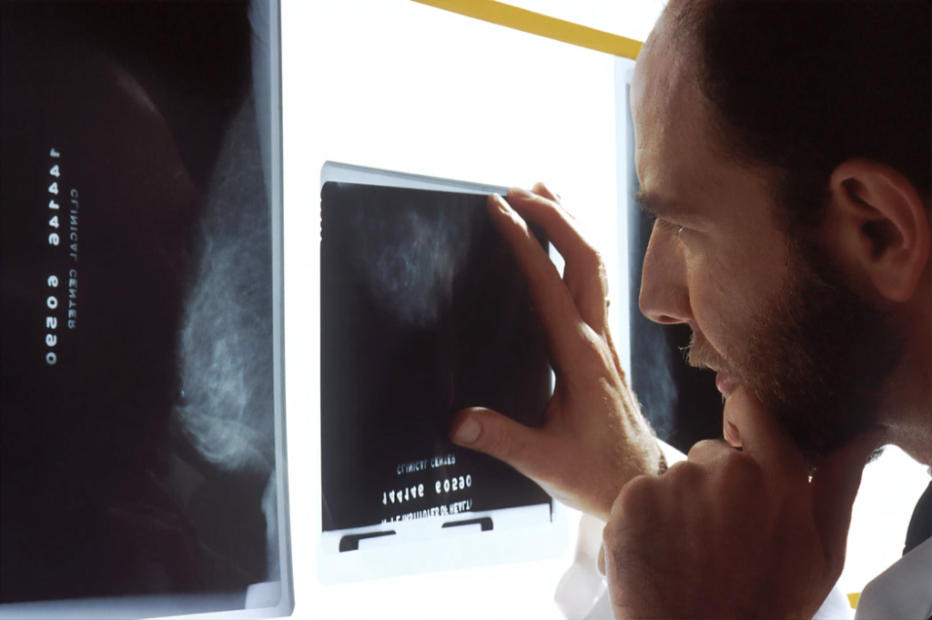 How Does Transcranial Doppler Technology Accurately Measure Strokes