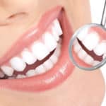 3 Ways of Teeth Straightening to Get the Perfect Smile!