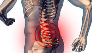 How to Slow Down Spinal Osteoarthritis